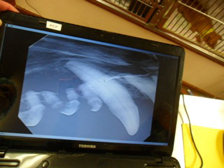 Dental X-ray