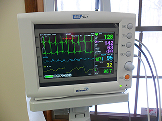 anesthesia monitor